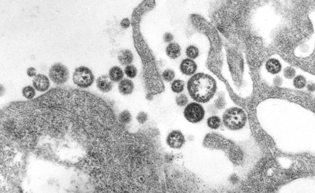 Lassa Fever Kills 188