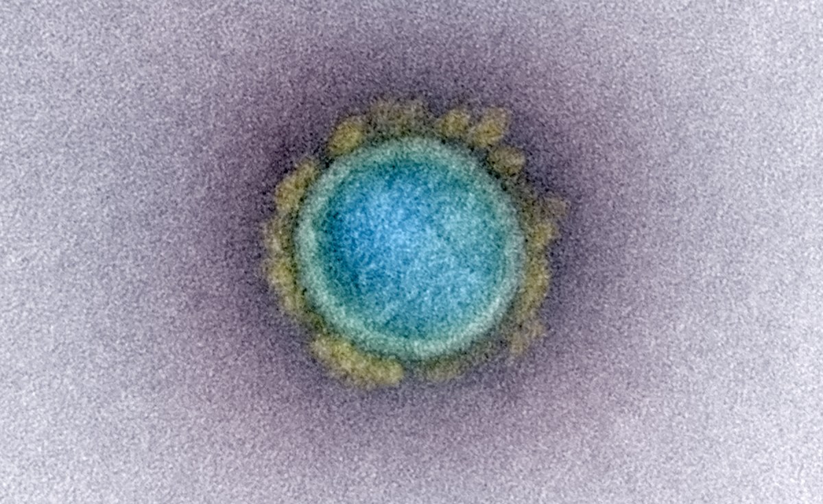 COVID-19 - Task Force Warns Against Buying Hydroxychloroquine