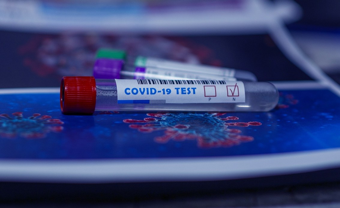Covid-19 Infections Lowest in Five Months